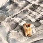Everything You Need to Know About Wisdom Teeth Growth