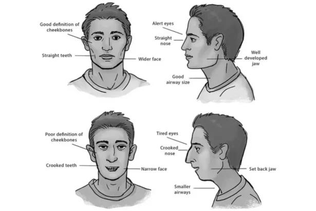 Mewing Claims and Realities Explained by Doctors