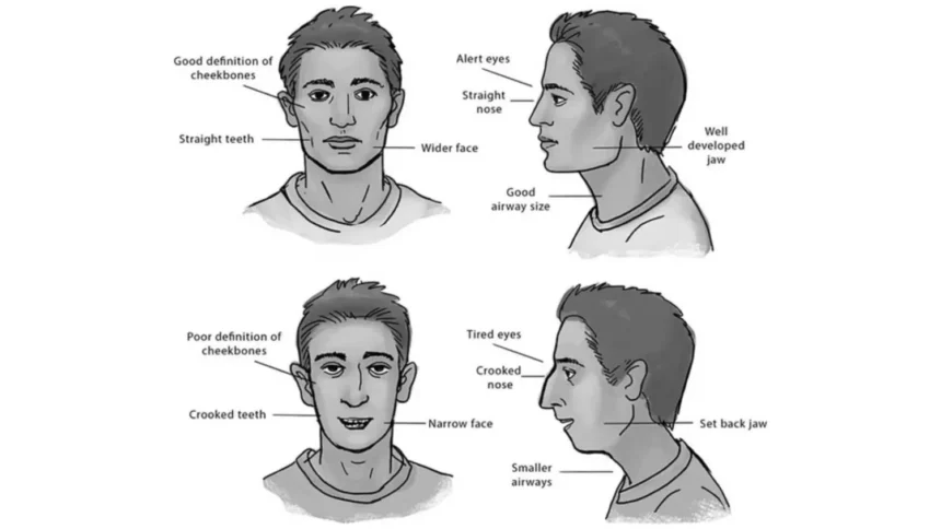 Mewing Claims and Realities Explained by Doctors